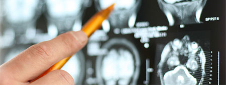 Neurologie Radolfzell